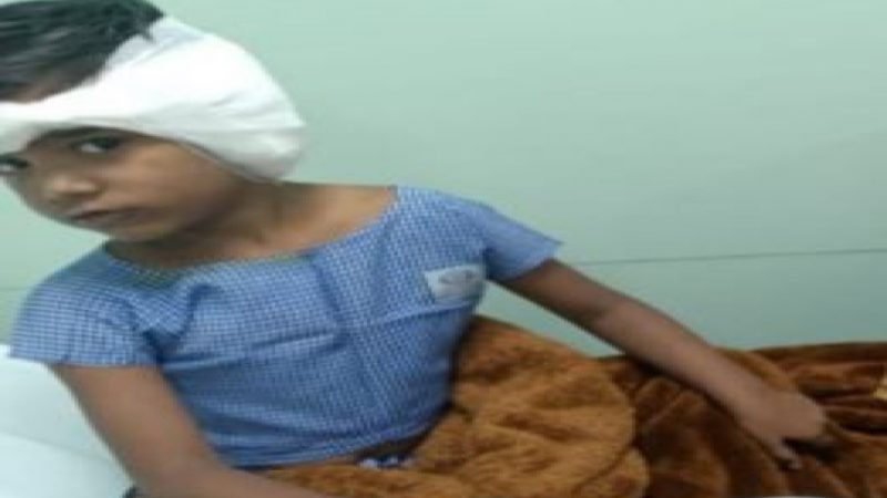 Pitbull  Attack in Ghaziabad: पिटबुल ने नोंचा बच्ची का कान, डॉग ऑनर के खिलाफ केस दर्ज
