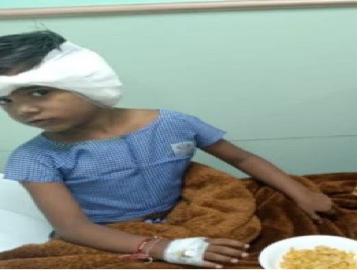 Pitbull  Attack in Ghaziabad: पिटबुल ने नोंचा बच्ची का कान, डॉग ऑनर के खिलाफ केस दर्ज