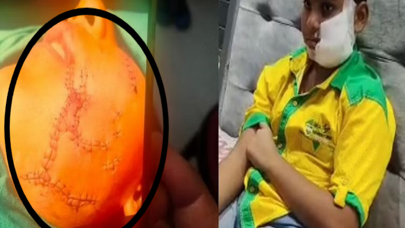 Ghaziabad Pitbull Dog Attack: पिटबुल ने बच्चे पर किया हमला, चेहरे पर आए 150 से ज़्यादा टांके