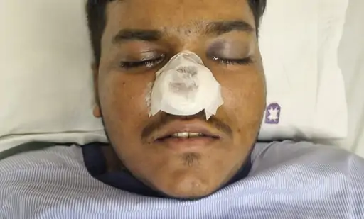 Ghaziabad Hospital case:  ऑपरेशन कराया नाक का, चली गई आंखों की रोशनी, छात्र में डॉक्टर के खिलाफ किया केस दर्ज