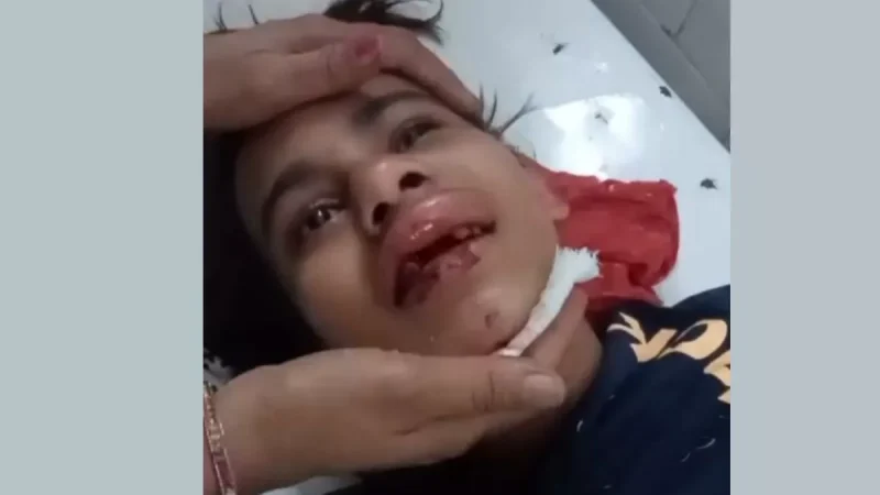 Ghaziabad news: महिला ने लड़की को तीसरी मंजिल से दिया धक्का, कई दांत टूटे, केस दर्ज