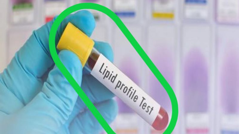 High Cholesterol Test: क्या आपके हार्ट पर मडरा रहा है खतरा.. लिपिड प्रोफाइल टेस्ट से इस तरह पता करें