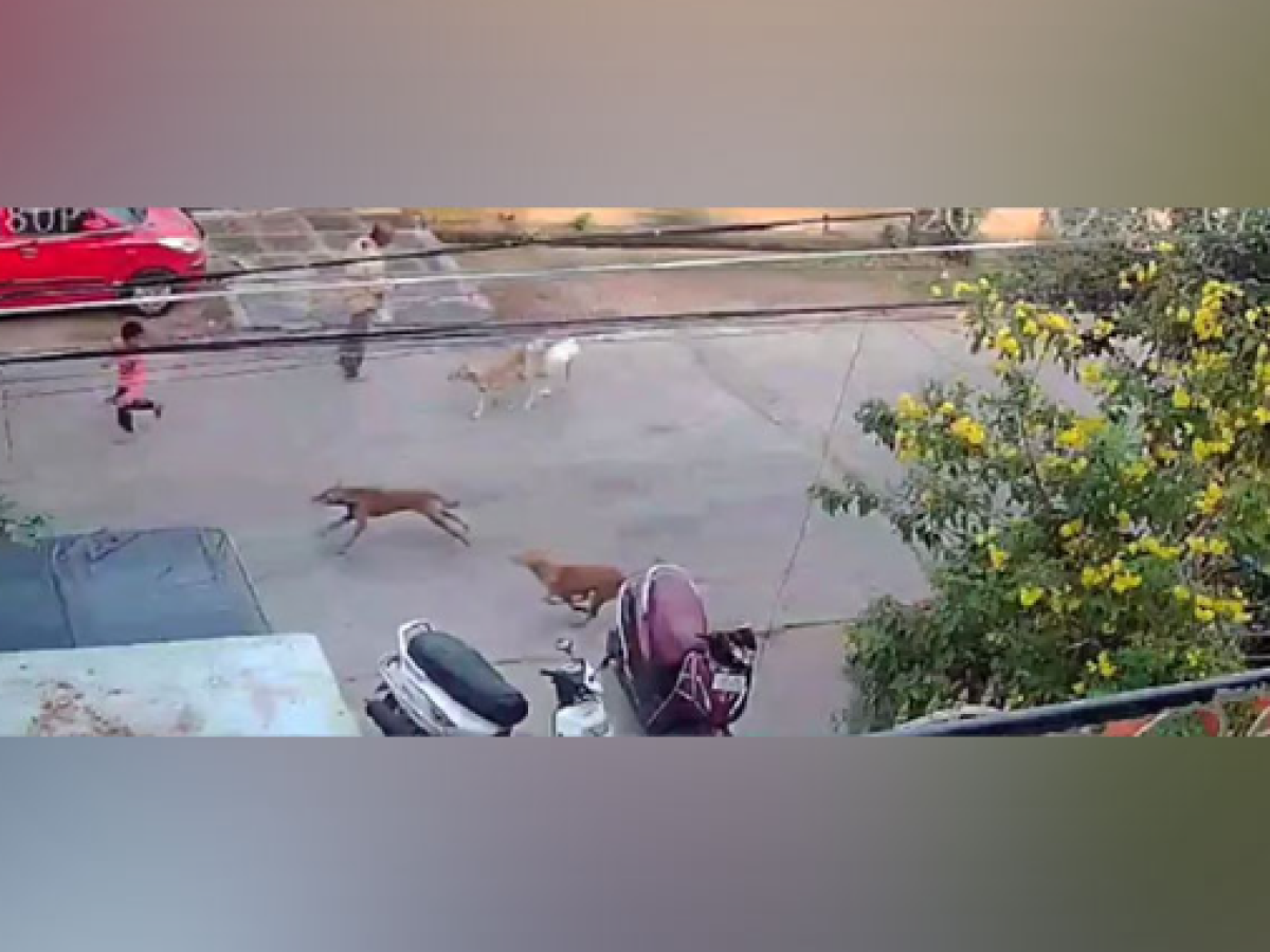 Stray Dog Attack: मासूम बच्चे पर कुत्तों के झुंड ने किया हमला, बुरी तरह नोचा