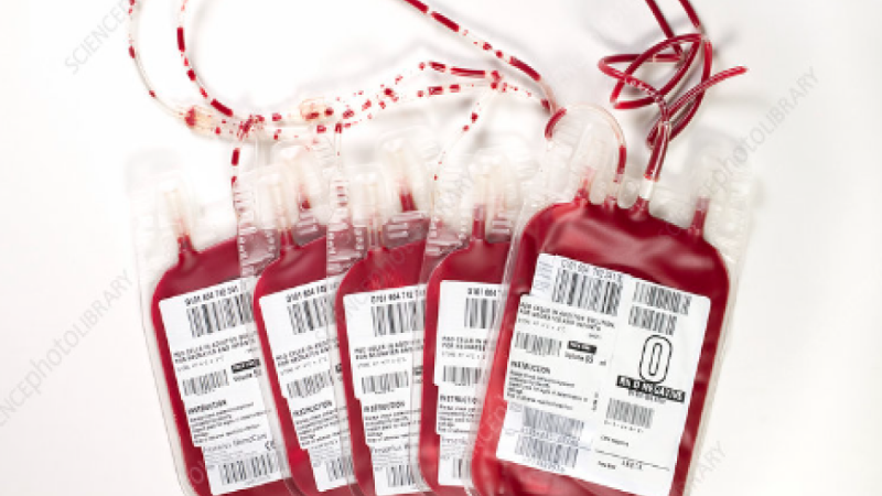 Blood Bank Govt. Guidelines: अब नहीं कर सकेंगे खून की खरीद और बिक्री, जानें क्या हैं सरकारी गाइडलाइंस