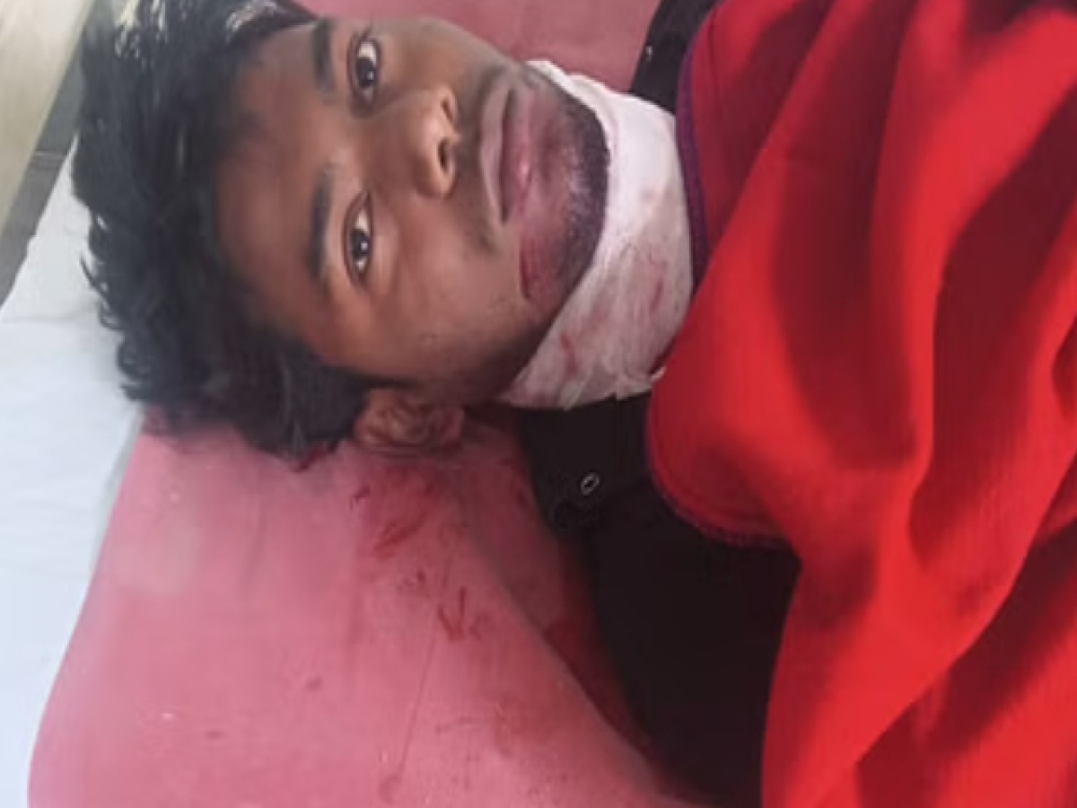 Ghaziabad News: मजदूरी के 500 रुपए मांगना पड़ा भारी, पेपर कटर से रेता स्टूडेंट का गला