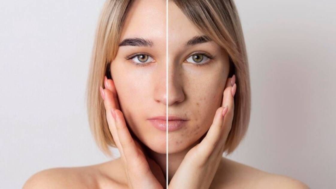 Skin care tips :- जानिए कुछ आसान तरीके, जिससे आप स्किन पिगमेंटेशन को कर सकते हैं दूर